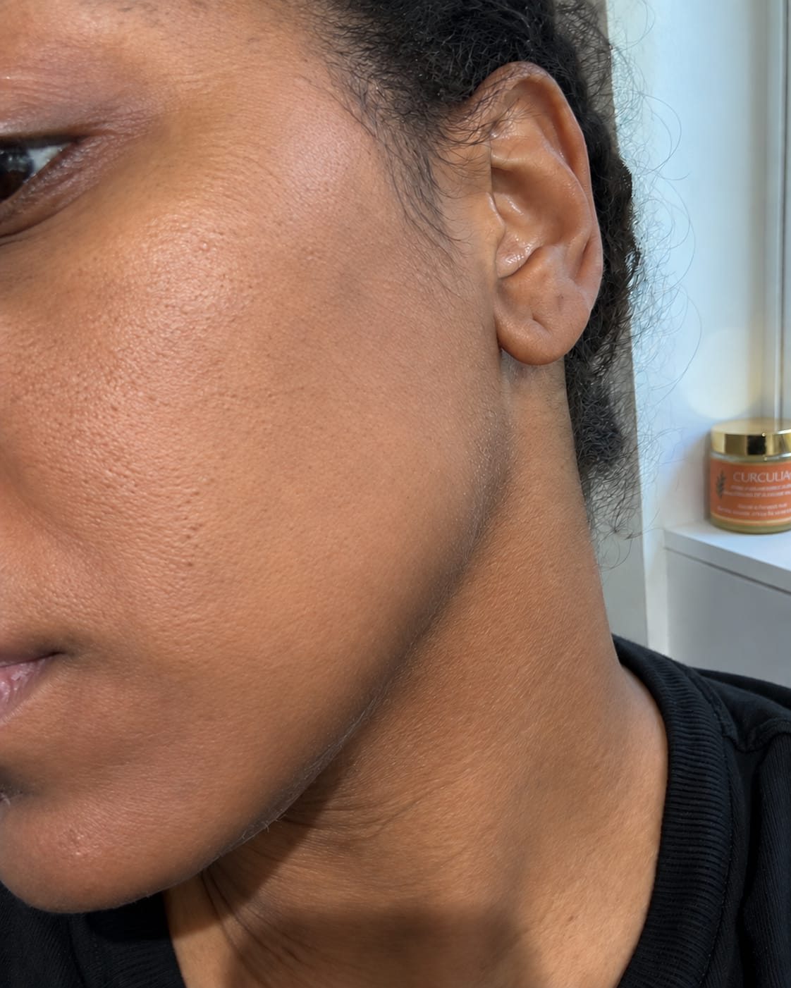 Customer photo review of Routine Anti-Imperfections 4 en 1
