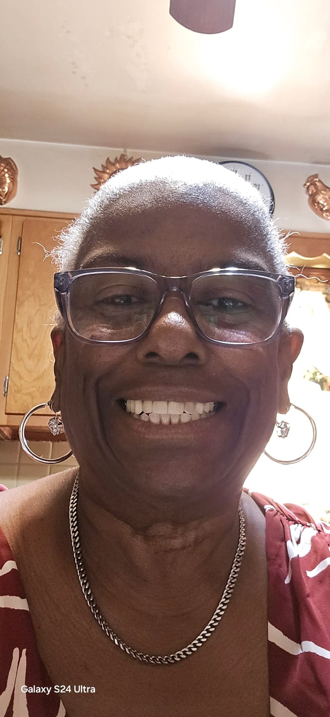Customer photo review of Figaro Silver (5mm)