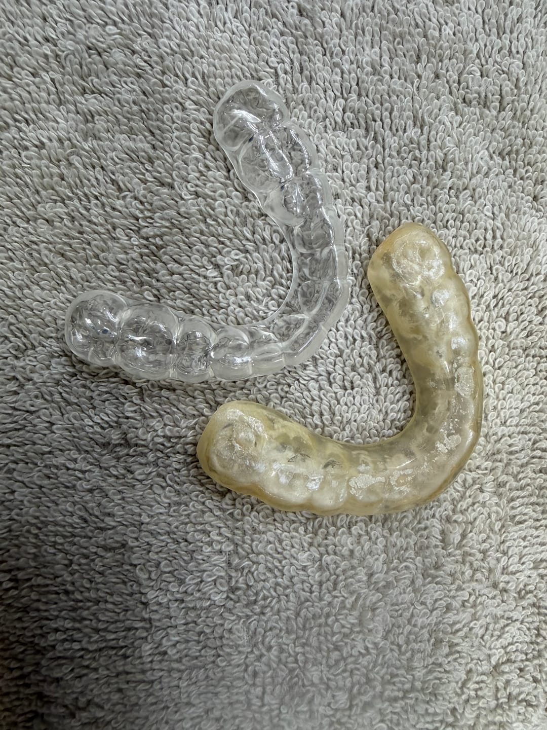 Customer photo review of Clear Custom Night Guard