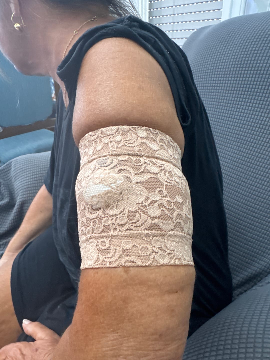 Customer photo review of Lace Armbands to Protect CGM and Insulin Pump - Dia-Band SPACY LACY