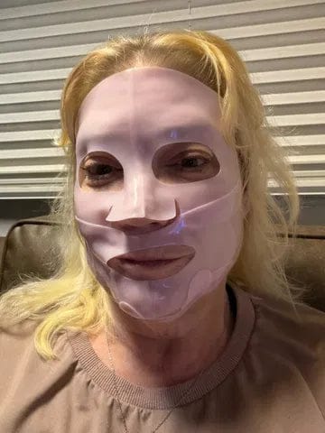 Customer photo review of Salmon PDRN Collagen Mask