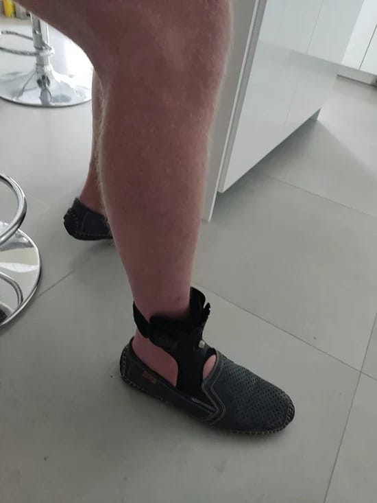 Customer photo review of OLORAZ™ Foot Drop Brace – Walk with Confidence Again