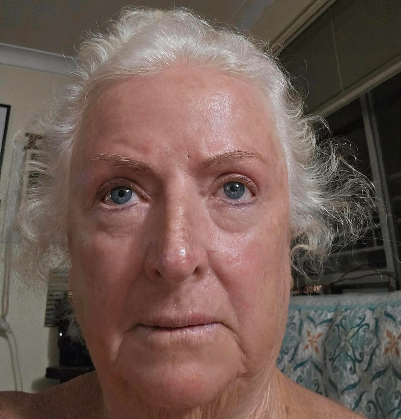 Customer photo review of Helloskin GHK-Cu 1.2% Triple-Peptide Face Serum