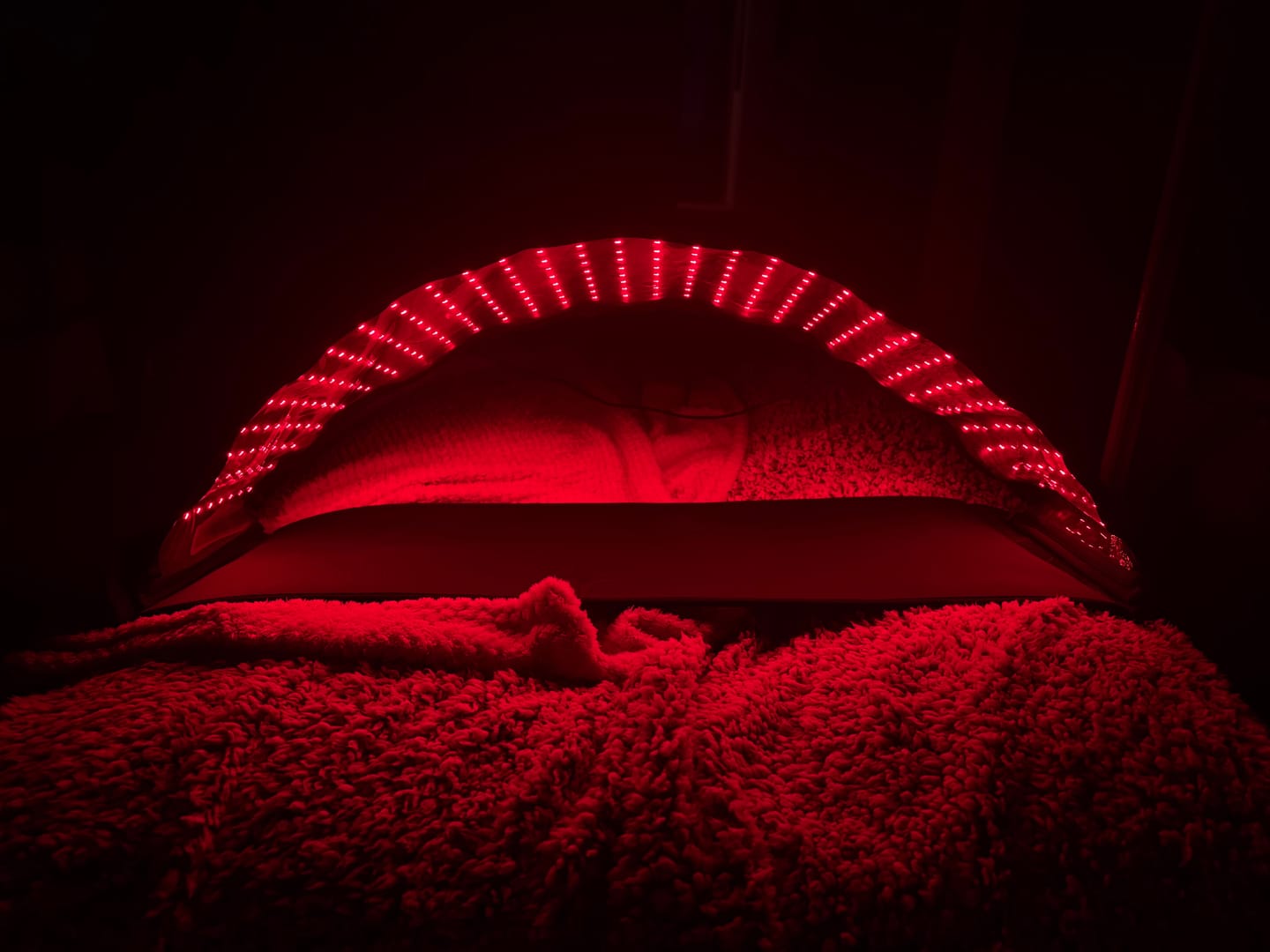 Customer photo review of LED Light Therapy Dome With 1064nm