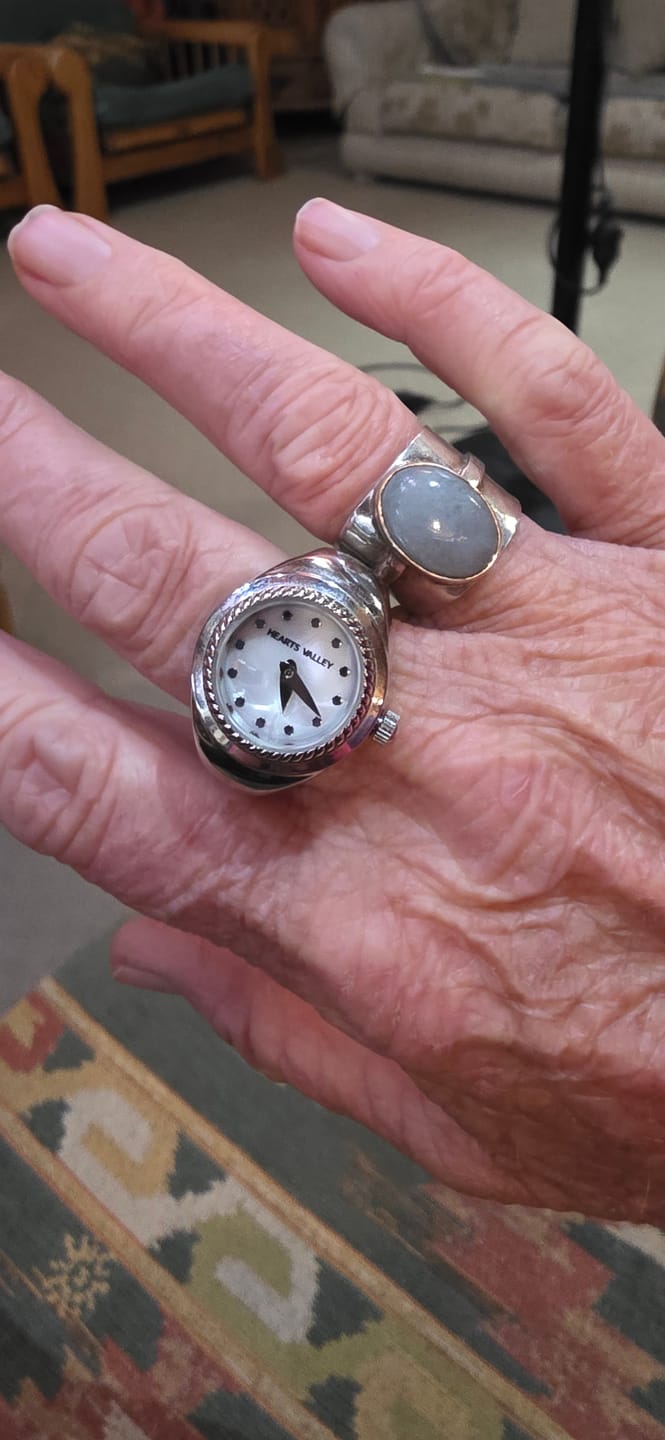 Customer photo review of Vivienne Watch Ring