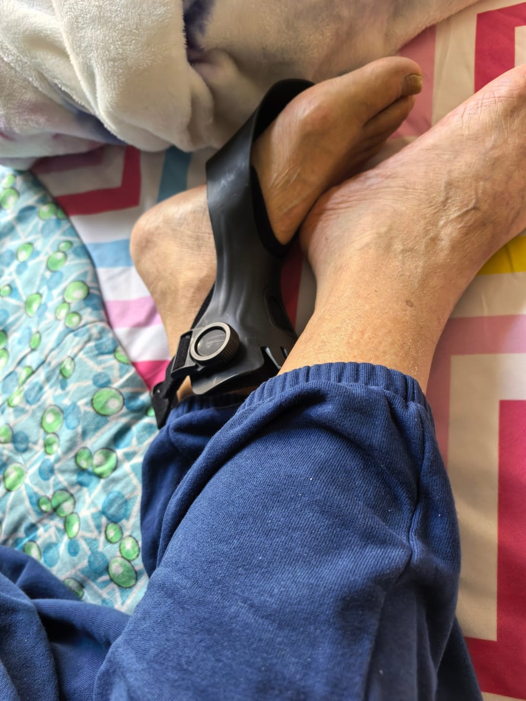 Customer photo review of OLORAZ™ Foot Drop Brace – Walk with Confidence Again