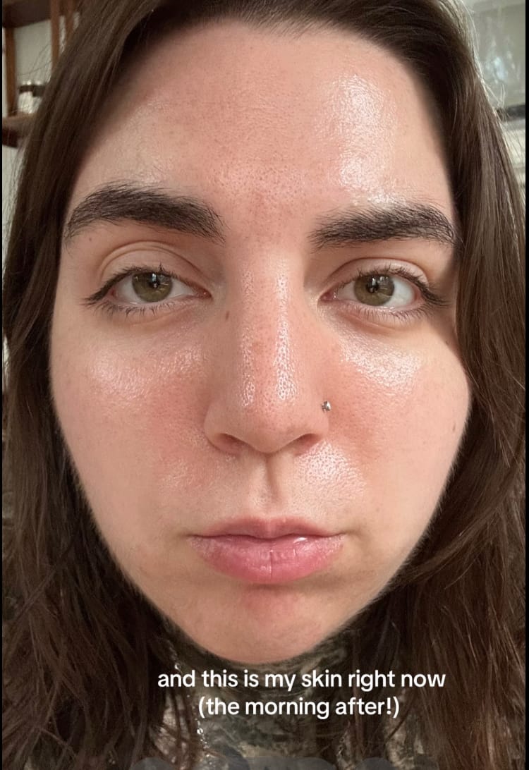 Customer photo review of Salmon PDRN Pink Collagen Jelly Gel Mask