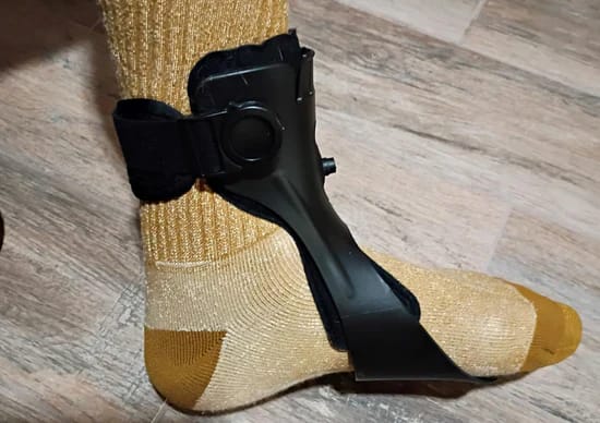Customer photo review of OLORAZ™ Foot Drop Brace – Walk with Confidence Again