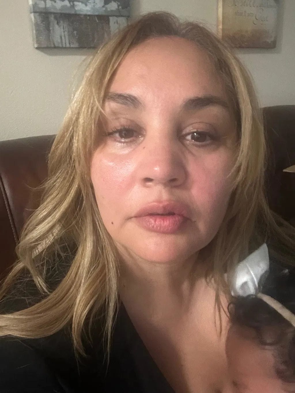 Customer photo review of Salmon PDRN Collagen Mask