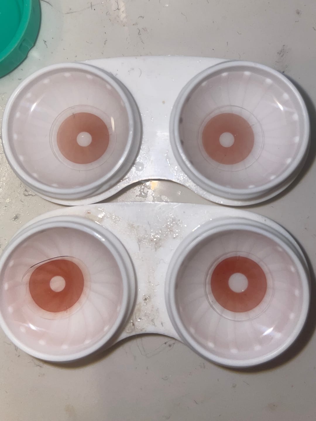 Customer photo review of Eyeling Toric Lenses for Astigmatism - 1 month