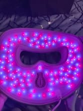 Customer photo review of Zora M300 LED Face Mask