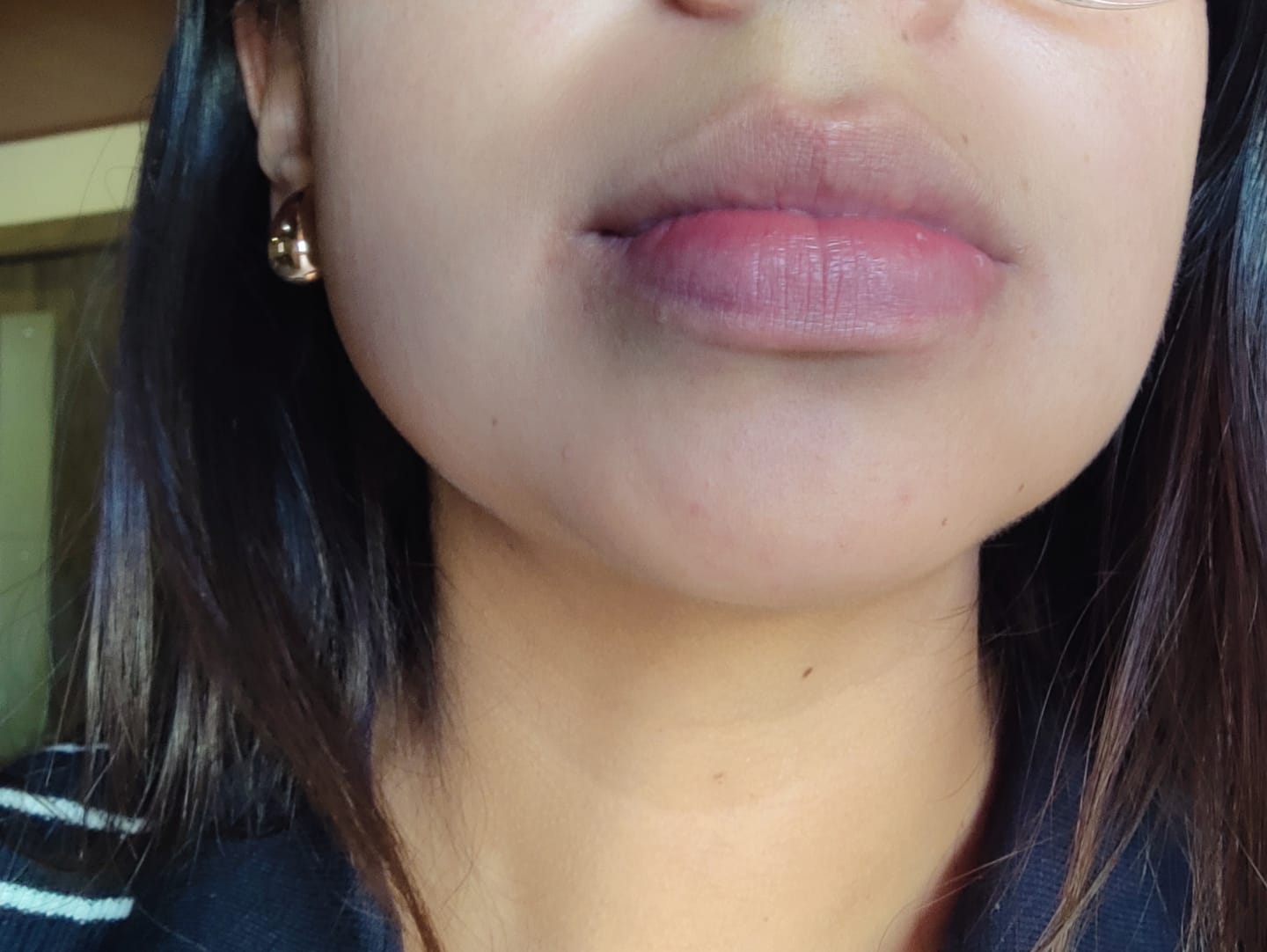 Customer photo review of DR. ALTHEA 345 relief cream