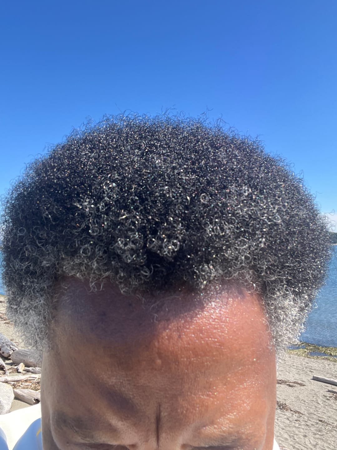 Customer photo review of Moisture and hair growth kit