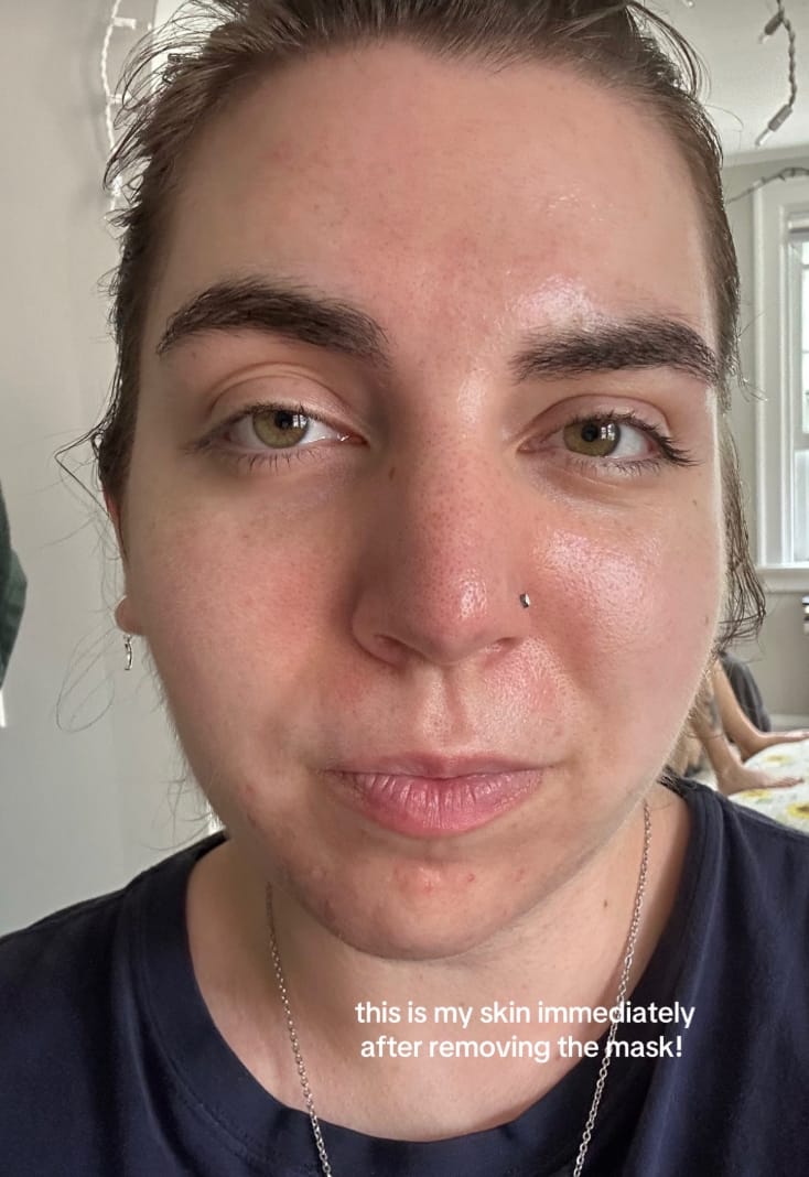 Customer photo review of Salmon PDRN Pink Collagen Jelly Gel Mask