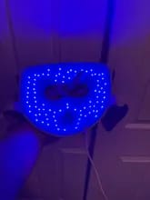 Customer photo review of Zora M300 LED Face Mask