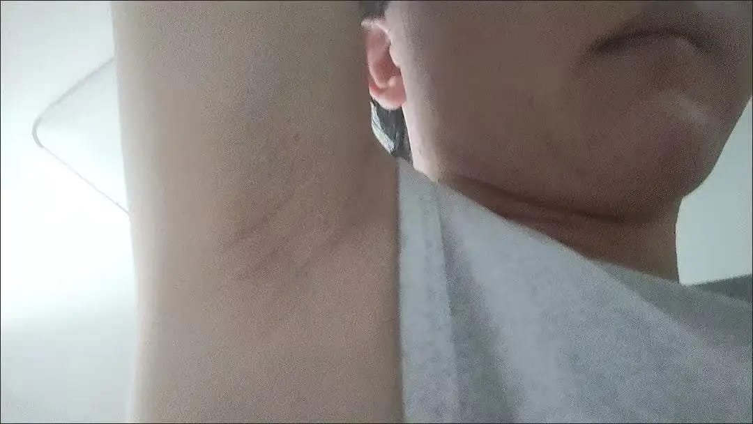 Customer photo review of AfterGlow Anti-Haarwuchs Serum